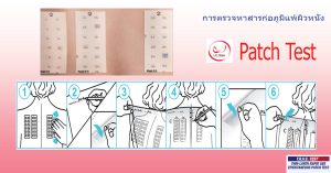 การตรวจหาสารก่อภูมิแพ้ที่ผิวหนังด้วย Patch Test