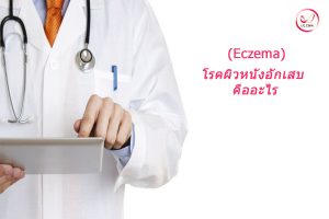 โรคผิวหนังอักเสบ (Eczema) คืออะไร สาเหตุ อาการ และการรักษา