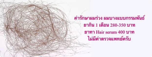 ค่ารักษาผมร่วง ผมบาง ยากิน ยาทา ซีรั่ม