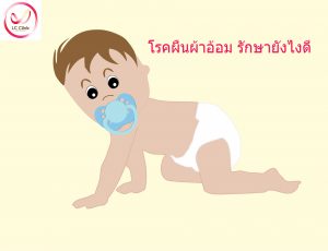 โรคผื่นแพ้ผ้าอ้อม (Diaper dermatitis) คืออะไร สาเหตุ อาการ การรักษา