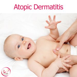 โรคผื่นภูมิแพ้ผิวหนัง (Atopic Dermatitis)