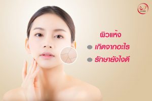 ผิวแห้ง โรคผิวหนังแห้ง Xerosis คืออะไร สาเหตุ อาการ การรักษา