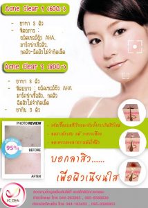 รักษา สิวทุกชนิด รอยสิว สิวที่หน้า สิวที่ตัวและหลัง ในโคราช & บุรีรัมย์