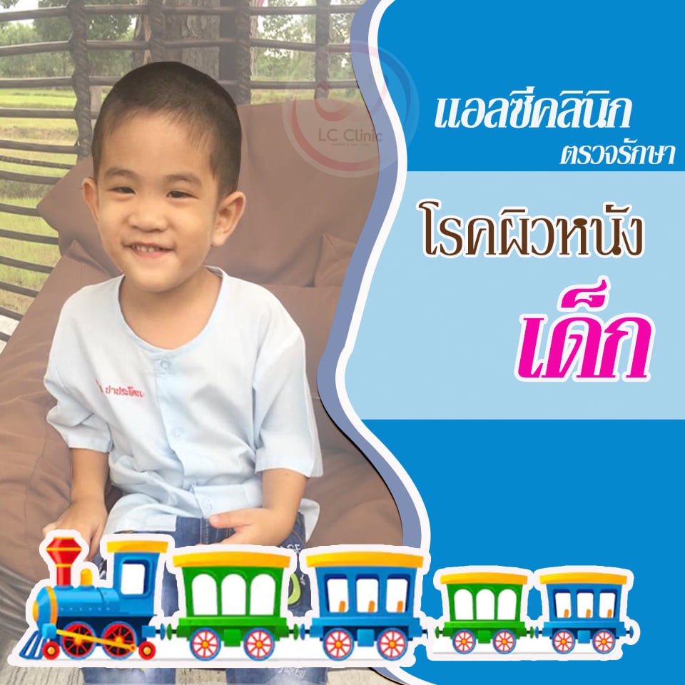 รักษา โรคผิวหนังเด็ก ภูมิแพ้ผิวหนัง ตุ่มพุพอง ผื่นคัน โคราช & บุรีรัมย์