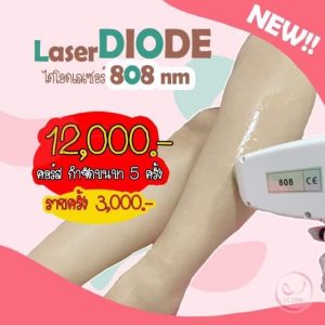 เลเซอร์ กำจัดขนขา ไดโอดเลเซอร์ Diode laser กำจัดขนถาวร ช่วยให้ผิวเรียบเนียน