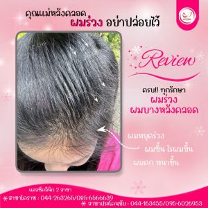 ผมร่วงหลังคลอด เกิดจากอะไร สาเหตุ อาการ การรักษา